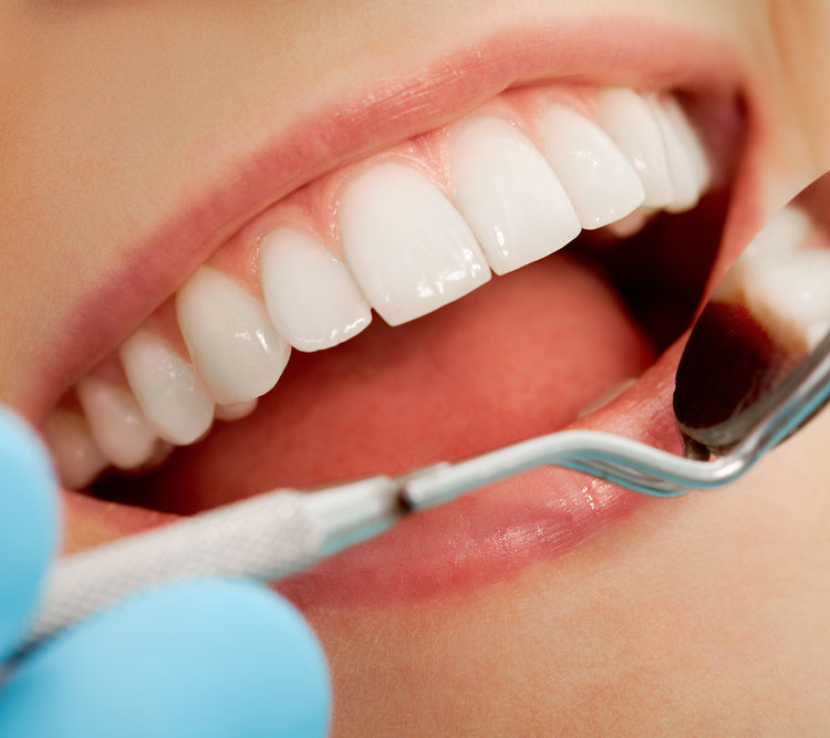 Profilaktyka chorób zębów